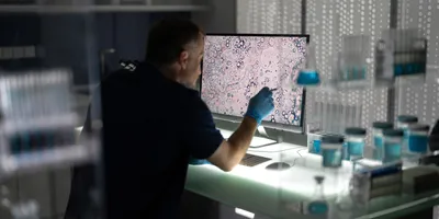Photo of a clinical laboratory scientist looking at a tissue biopsy scan on a computer monitor.