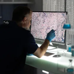 Photo of a clinical laboratory scientist looking at a tissue biopsy scan on a computer monitor.