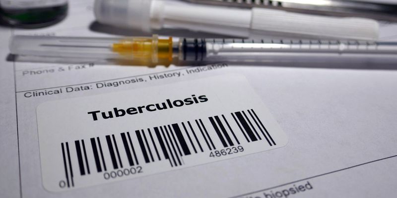Tb Testing Lab New Portable TB Test Matches Lab Accuracy in Minutes | Today's Clinical Lab