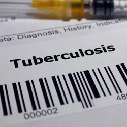 Global health experts have long sought a more rapid form of point-of-care Tuberculosis testing.
