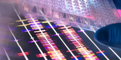 Image of a PCR plate on top of next-generation sequencing results for bacterial identification in the clinical laboratory.