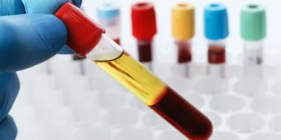 Cell-free DNA is now being applied across multiple areas of medicine, including prenatal testing, oncology, transplantation, and infectious disease.