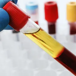Cell-free DNA is now being applied across multiple areas of medicine, including prenatal testing, oncology, transplantation, and infectious disease.