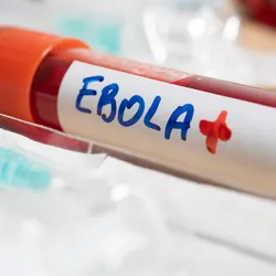 Blood sample labeled for sample testing related to Ebola Bundibugyo virus outbreak.