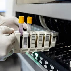 Laboratory technician preparing samples for pediatric testing in a clinical laboratory.
