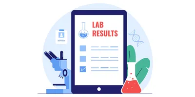 Digital results of a commercial diagnostic lab test with a microscope and beaker.