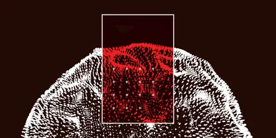 Representation of analysis using blood-based biomarkers for Alzheimer's disease.