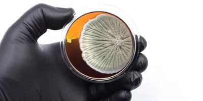 Laboratory professional holding a culture plate for TMVII testing