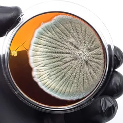 Laboratory professional holding a culture plate for TMVII testing