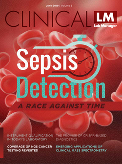 Sepsis Detection: A Race Against Time